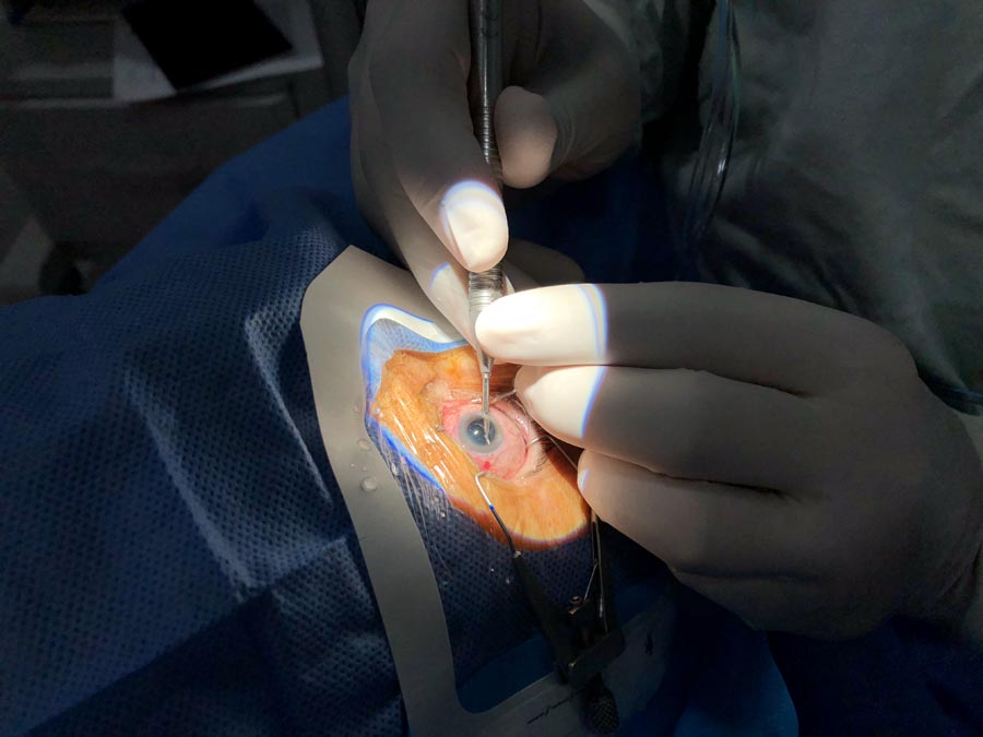 rafael-garcia-retinologo_1032