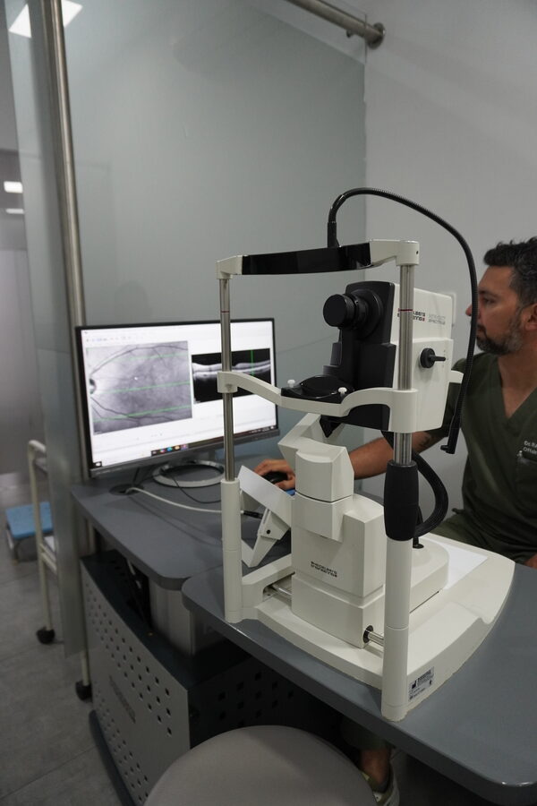 TOMOGRAFÍA MACULAR