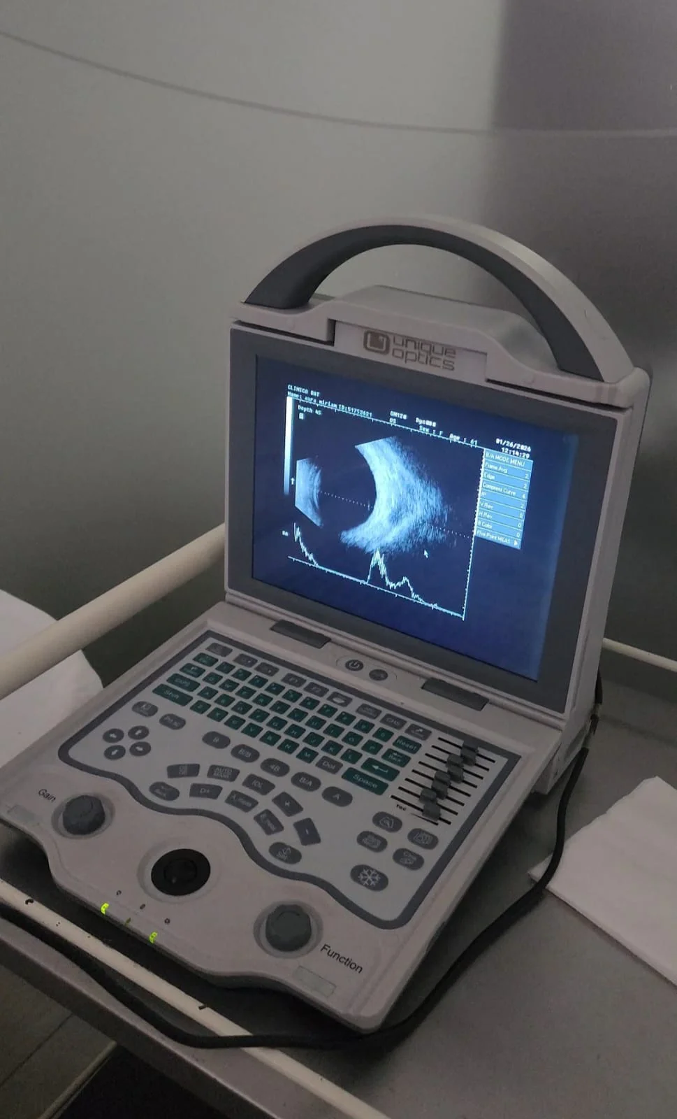 UNIQUE OPTICS ENCENDIDO